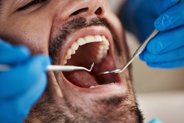 Best Urgent Tooth Repair  in Quitman, TX