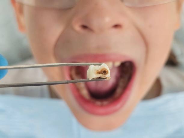 Best Broken Tooth Emergency  in Quitman, TX